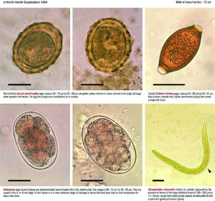 Eimeria! Un Parasite Microscopique Qui Déclenche le Chaos dans l'Intestin des Animaux Domestiques