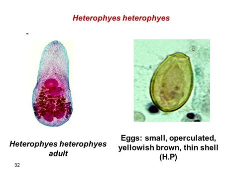  Heterophyes: Un ver plat avec des aventures intestinales étonnantes!