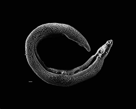  Schistosoma: Parasite de l'eau douce et maître du camouflage!