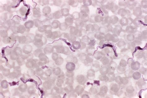  Trypanosoma: Un flagellé microscopique aux aventures palpitantes dans le sang !